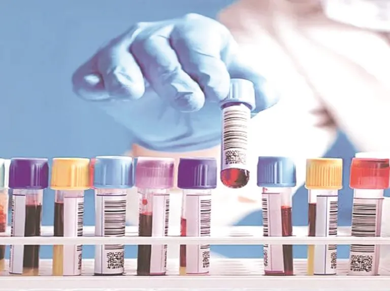 Lal PathLabs to increase penetration in western India
