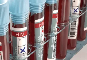 HIV- एचआईवी