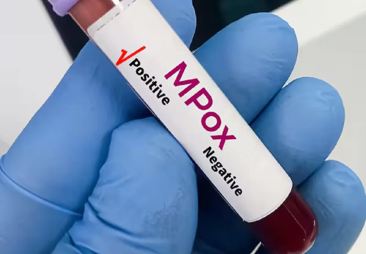 Mpox Virus