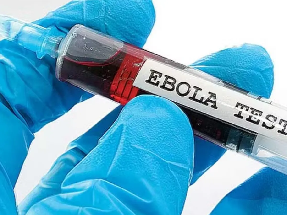 Ebola Virus